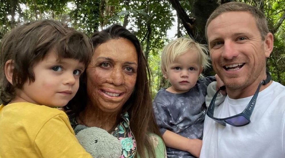 Turia Pitt and his family 